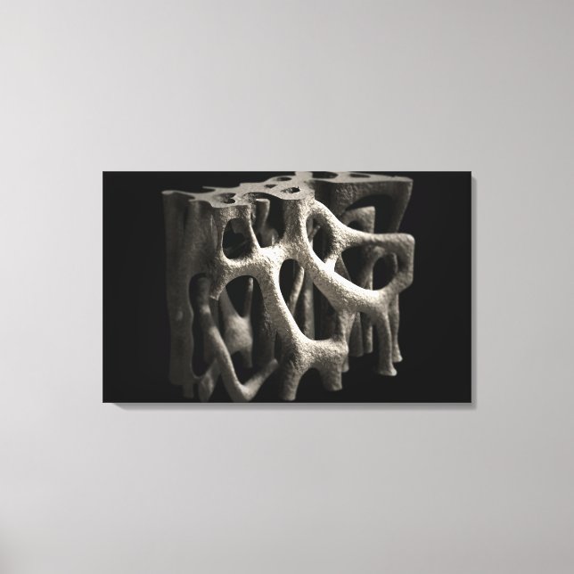 Structure of a bone with osteoporosis canvas print (Front)