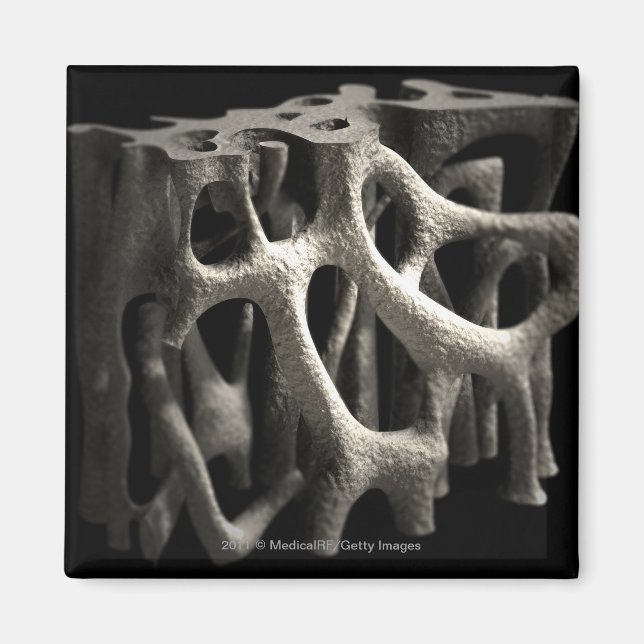 Structure of a bone with osteoporosis magnet (Front)