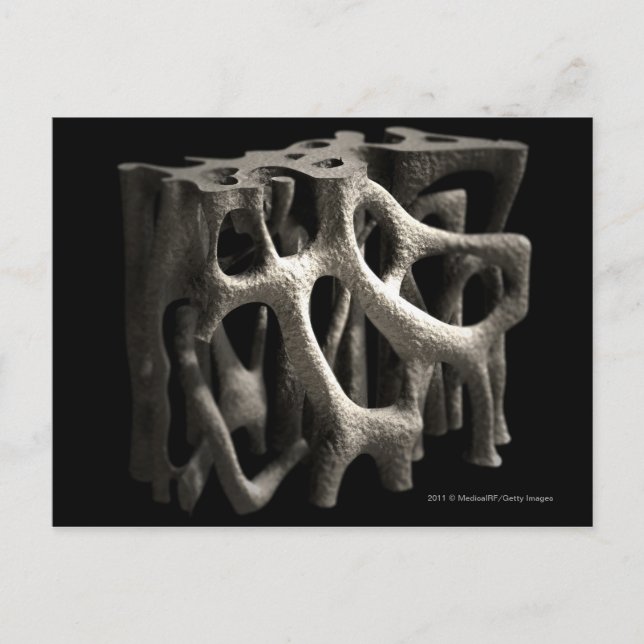 Structure of a bone with osteoporosis postcard (Front)