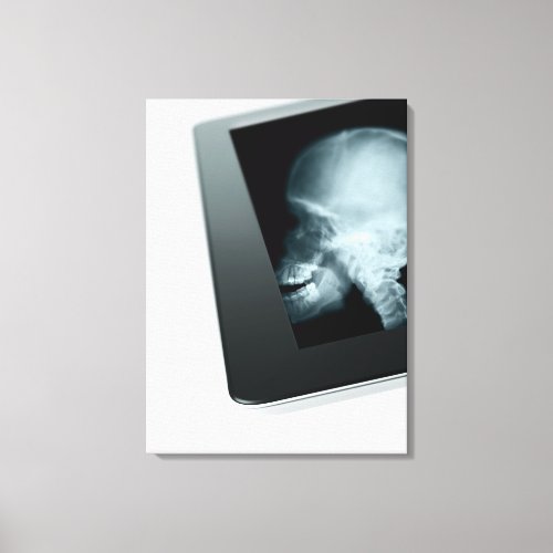 Studio shot of digital tablet with x_ray of canvas print