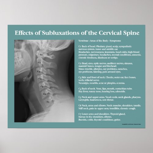 Subluxation Effects Spine Poster Chiropractic