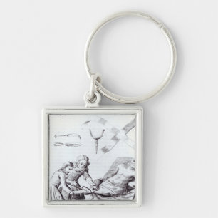 Surgical operation to amputate a leg keychain