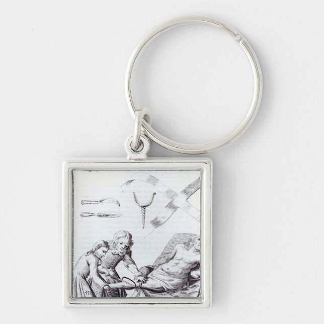 Surgical operation to amputate a leg keychain (Front)