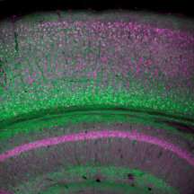 Microscopy images