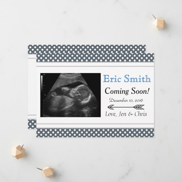 Simple Unisex Ultrasound Baby Announcement