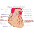 Diagram of the Coronary Arteries of a Human Heart Poster ...