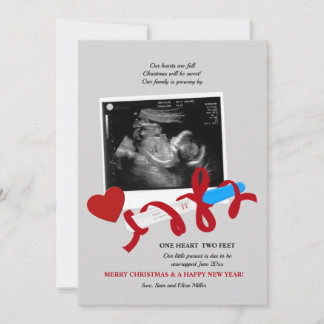 Sweet Christmas Holiday Pregnancy Announcement