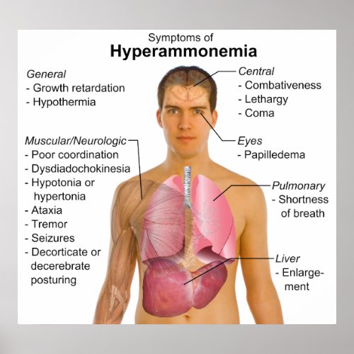 Symptoms Chart of Metabolic Disease Hyperammonemia