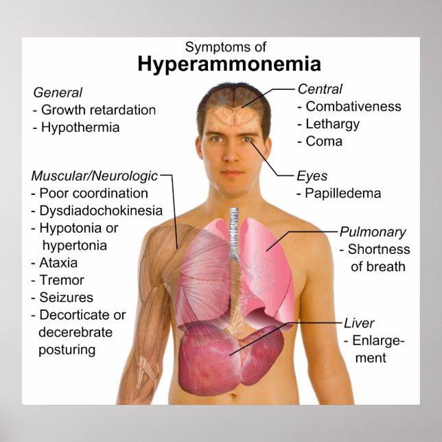 Symptoms Chart of Metabolic Disease Hyperammonemia (Front)