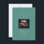 Teal My 1st Baby Gift Funny Thank You Card<br><div class="desc">Teal.  Ultrasound.  Funny Baby Perspective Baby Shower Thank You Card.</div>