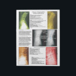 Tear Off Pad Lumbar Spinal Degeneration<br><div class="desc">Radiology views of the lumbar spine showing the 4 phases of spinal degeneration. Color coded to help explain xrays during report of findings with your patient. Common conditions are listed with each phase. Patient education handout for the chiropractic clinic.</div>