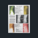 Tear Off Pad Lumbar Spinal Degeneration<br><div class="desc">Radiology views of the lumbar spine showing the 4 phases of spinal degeneration. Color coded to help explain xrays during report of findings with your patient. Common conditions are listed with each phase. Patient education handout for the chiropractic clinic.</div>
