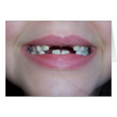 teeth (Front Horizontal)