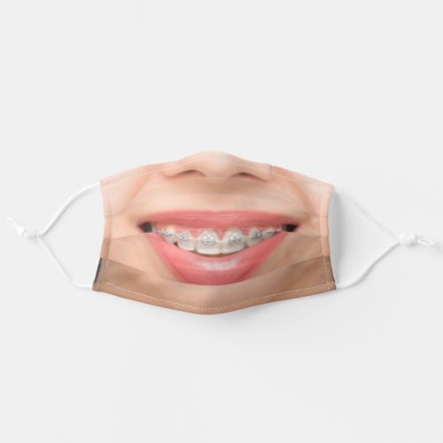 Teeth Braces _ Big Smile _ Add Your Photo _ Funny Adult Cloth Face Mask