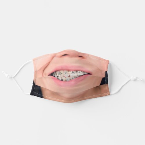 Teeth Braces Crooked Smile _ Add Your Funny Photo Adult Cloth Face Mask
