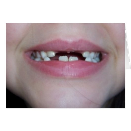 teeth cards (Front Horizontal)