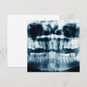 Teeth X-ray (Front/Back)