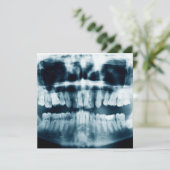 Teeth X-ray (Standing Front)
