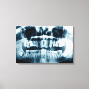 Teeth X-ray Canvas Print