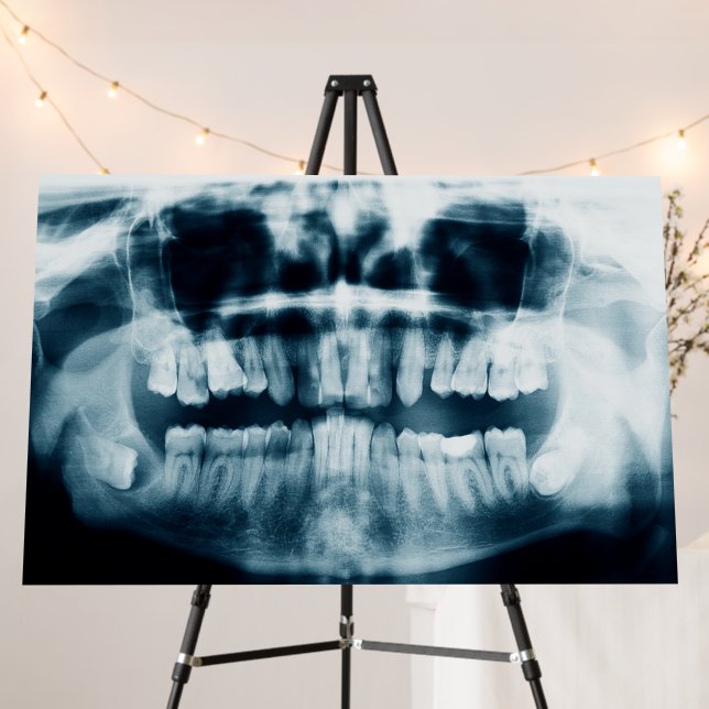 Teeth X-ray Foam Board (In Situ (Stand))