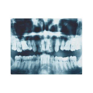 Teeth X-ray Metal Print
