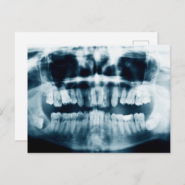 Teeth X-ray Postcard (Front/Back)