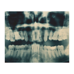 Teeth X-ray Wood Wall Art