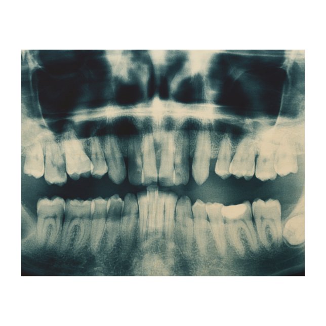 Teeth X-ray Wood Wall Art (Front)