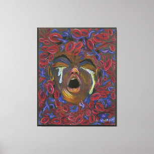 Ten Redefined - Sickle Cell Pain Awareness Canvas Print