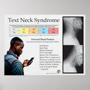 Text Neck Pain Syndrome Chart