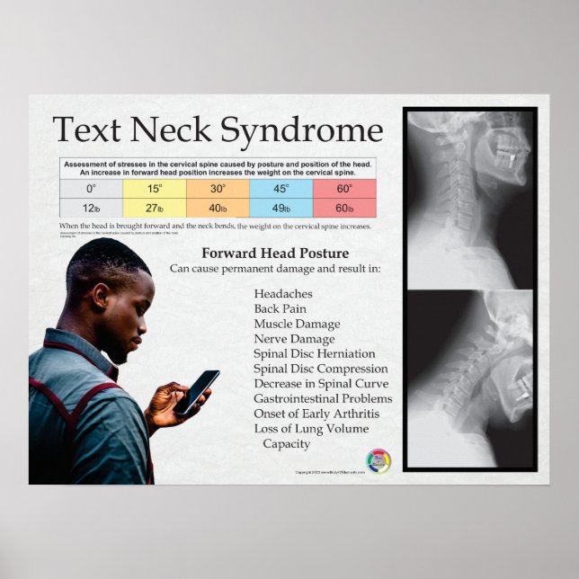 Text Neck Pain Syndrome Chart (Front)