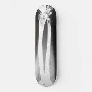 The Breaks skateboard by Bradley Boness Deck