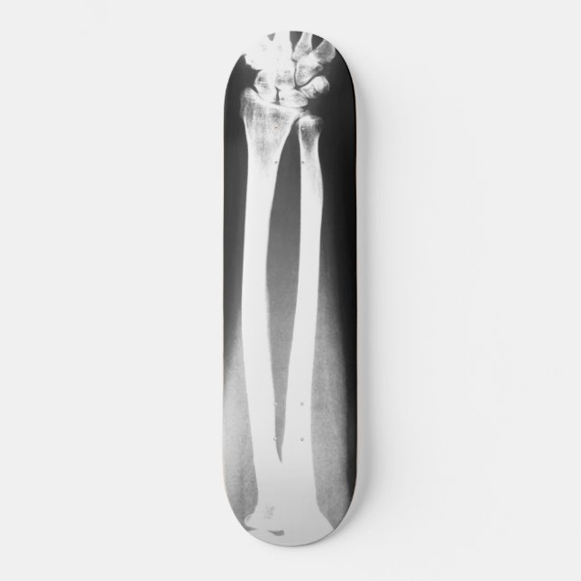 The Breaks skateboard by Bradley Boness Deck (Front)