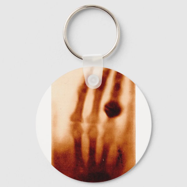 The First X-Ray, 1901, Photograph Keychain (Front)