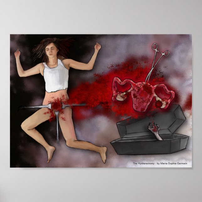 The Hysterectomy Poster (Front)