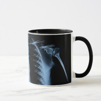 The X-ray Mug