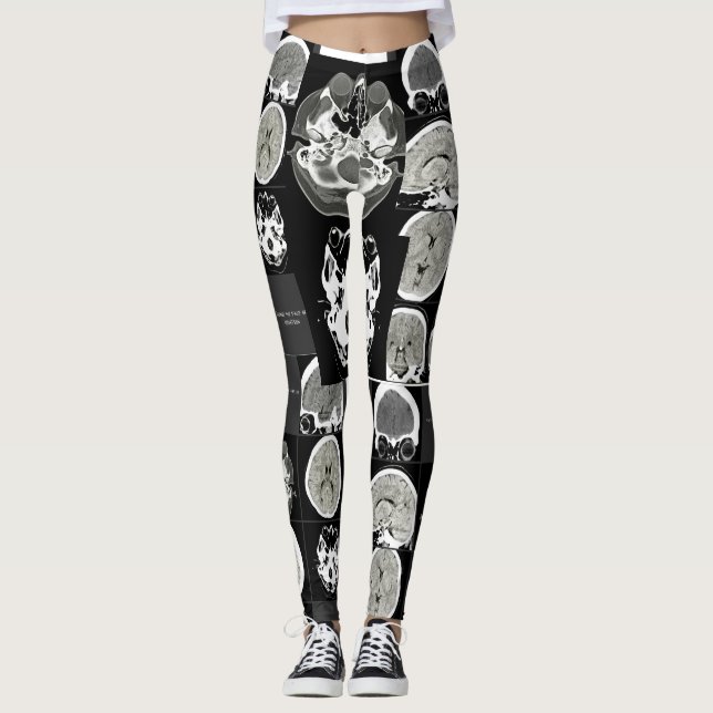 this is what depression looks like_CTFOD Leggings (Front)