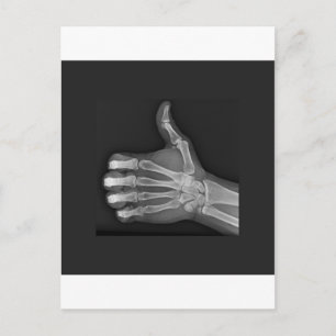 Thumbs up postcard