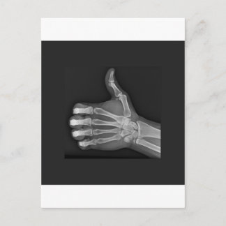 Thumbs up postcard