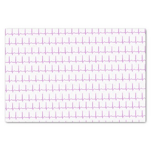 Tissue paper _ Normal Sinus Rhythm EKG