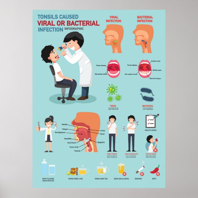 Tonsils caused viral infection   poster (Front)