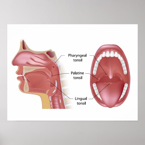 Tonsils Poster