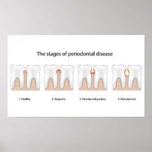 Periodontal Posters & Prints | Zazzle