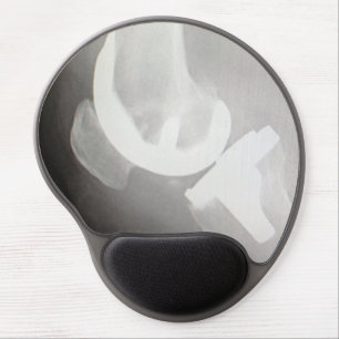 Total Knee Replacement Mousepad