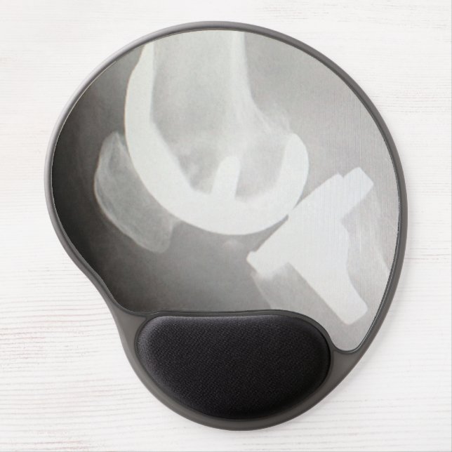 Total Knee Replacement Mousepad (Front)