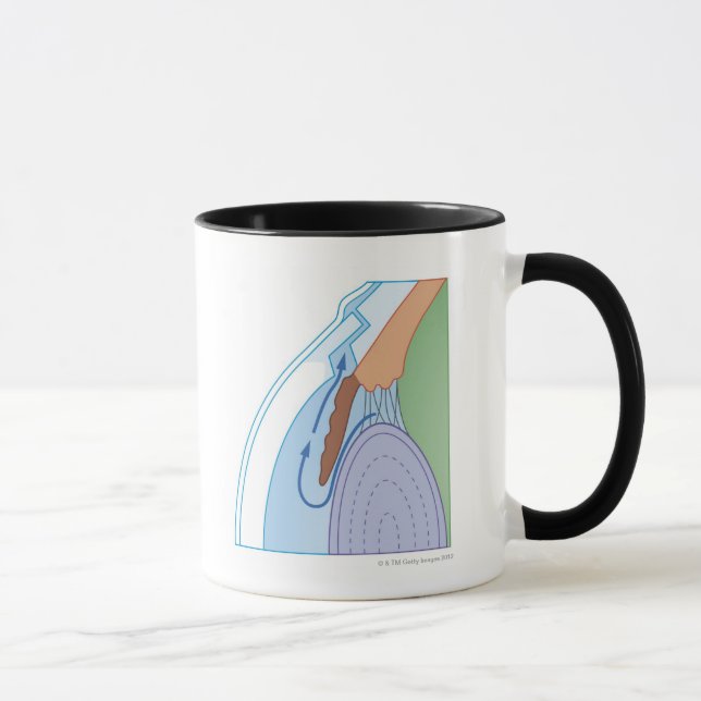 Trabeculectomy Procedure Mug (Right)
