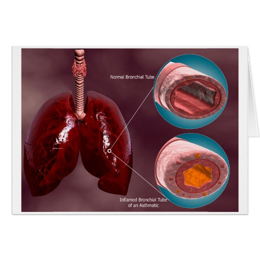 Trachea Cross-Section With Lungs Cards (Front Horizontal)