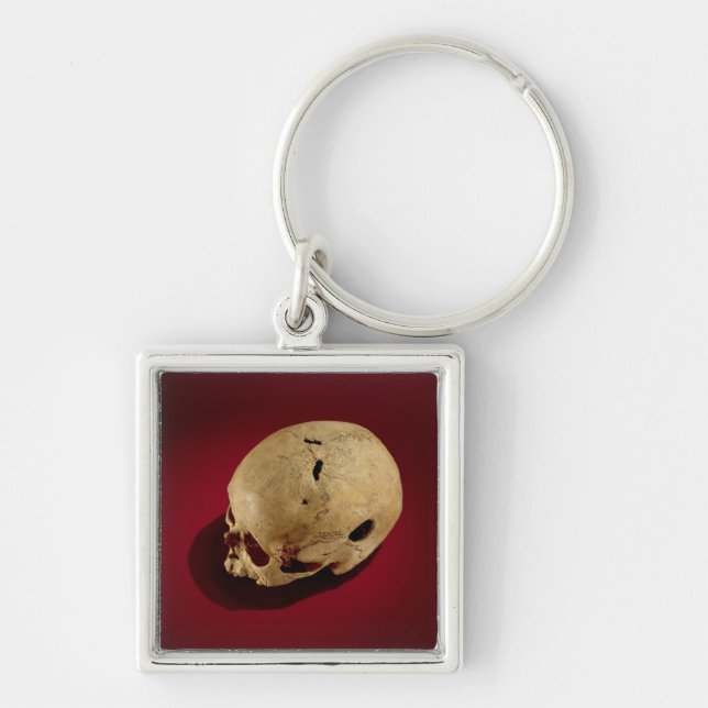 Trepanned Skull Keychain (Front)