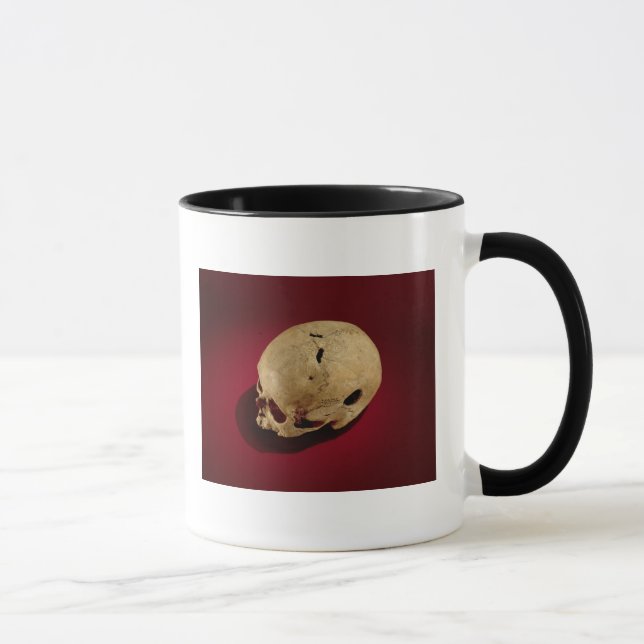 Trepanned Skull Mug (Right)
