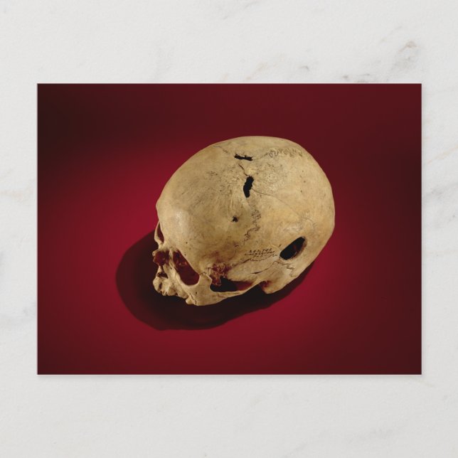 Trepanned Skull Postcard (Front)